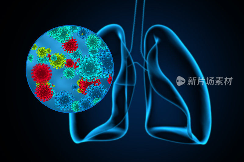 冠状病毒对肺部