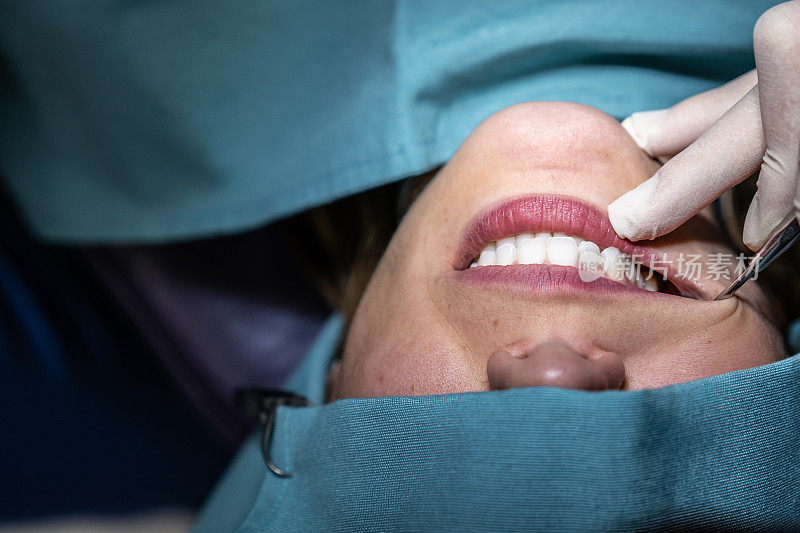 牙科医生在手术室里检查病人的牙齿和口腔