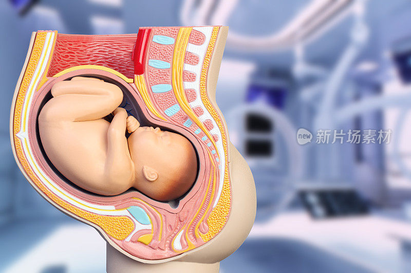 手术室妊娠模型