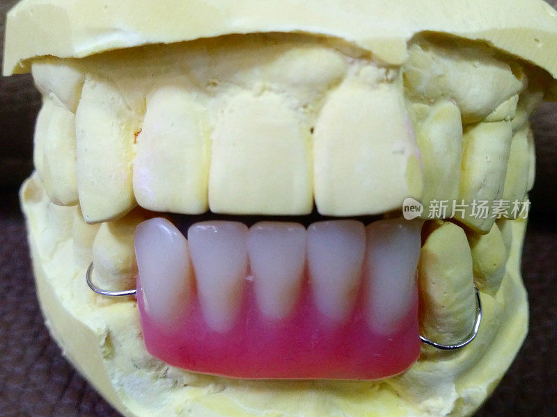 牙科门诊VH544临时牙