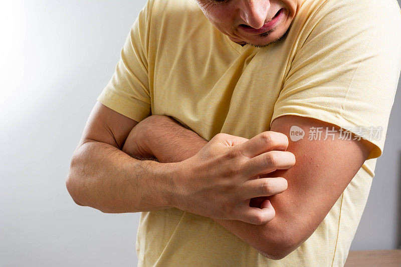 过敏会在男性皮肤上引起皮疹