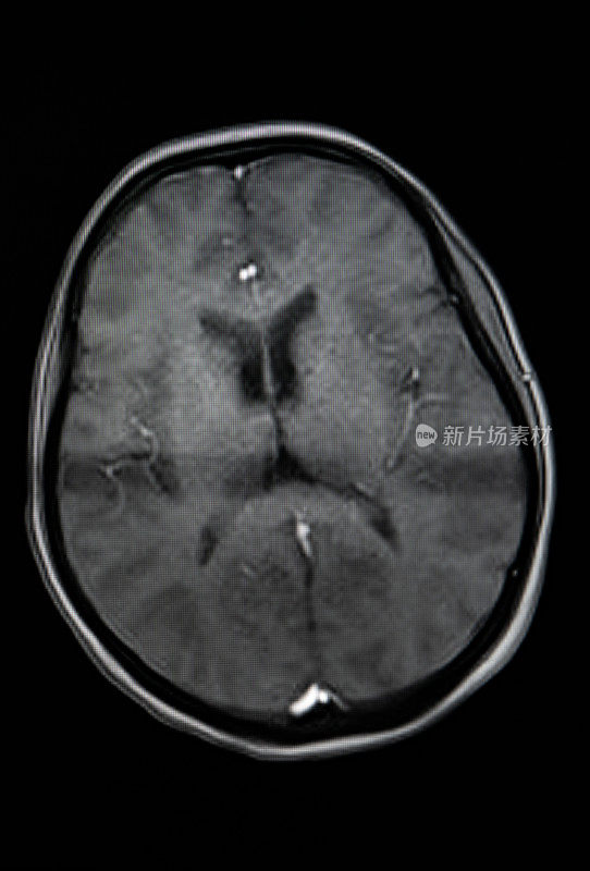 大脑核磁共振扫描。扫描大脑磁共振图像。诊断医疗工具