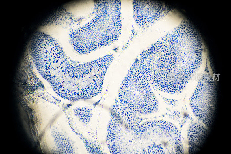 显微镜下睾丸活检图