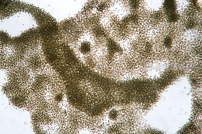 微囊藻，淡水浮游植物蓝藻菌落。超宏观显微镜。水开花污染的生态问题