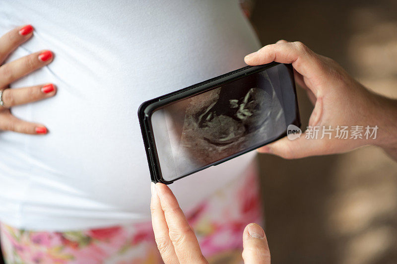 一对夫妇在怀孕的肚子上用智能手机显示超声波图