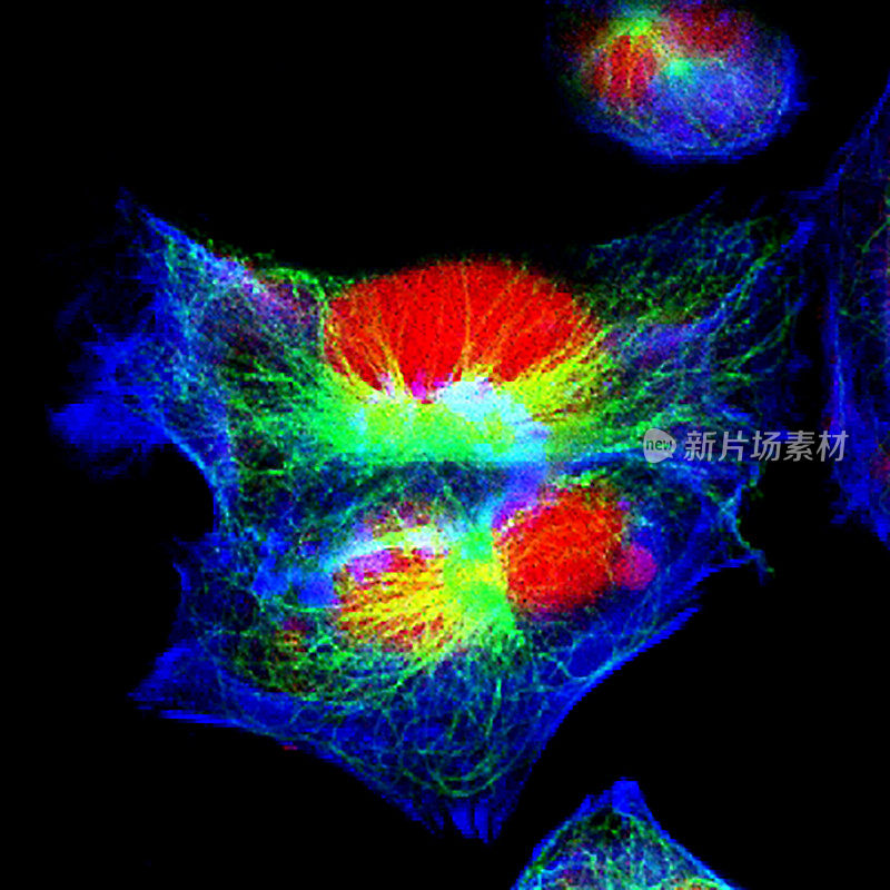 神经母细胞瘤细胞