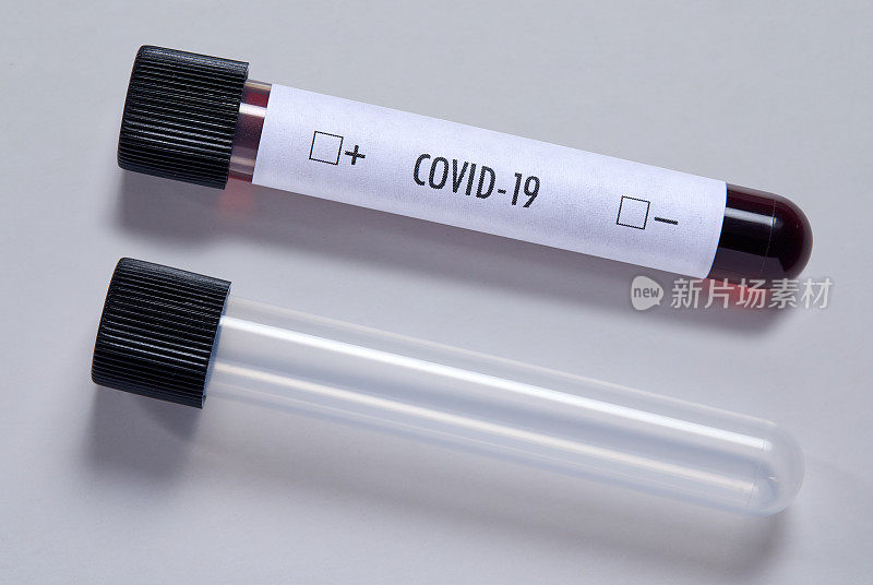 血液样本COVID-19
