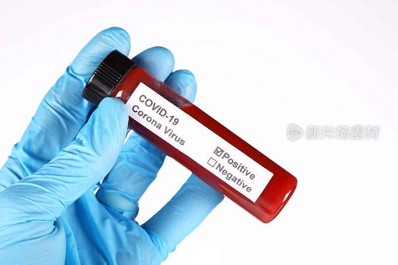 COVID-19血液检测阳性白色背景水平