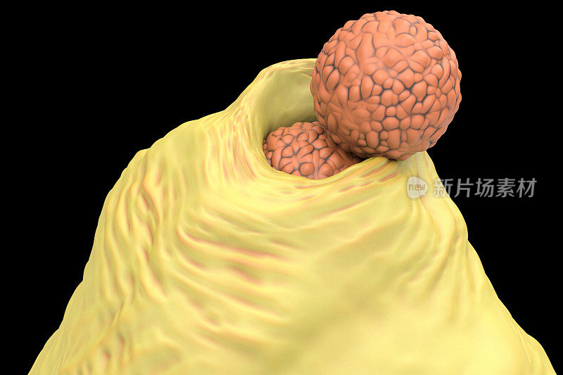 中性粒细胞摄取MRSA细菌，3D图像