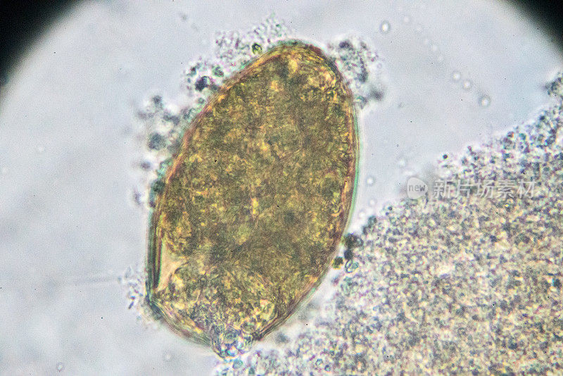 光镜下支气管吸虫卵
