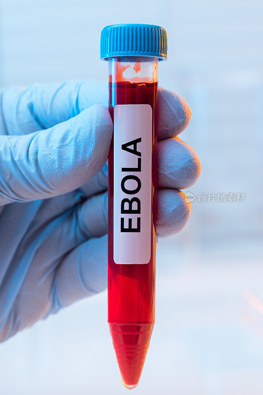 Ebola