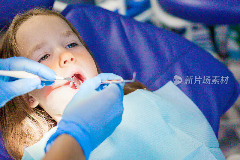 小女孩坐在牙医的椅子上。儿童牙医检查乳牙。儿童牙科治疗。预防儿童龋齿