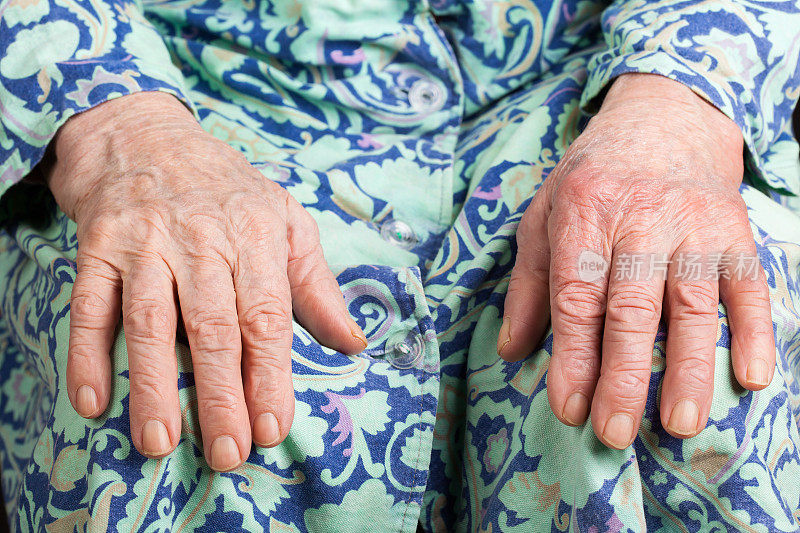 一个老妇人的手