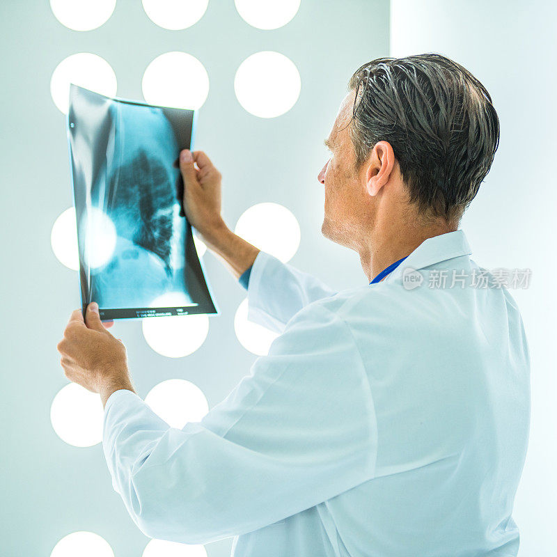 医生正在检查冠状病毒病人的x光片