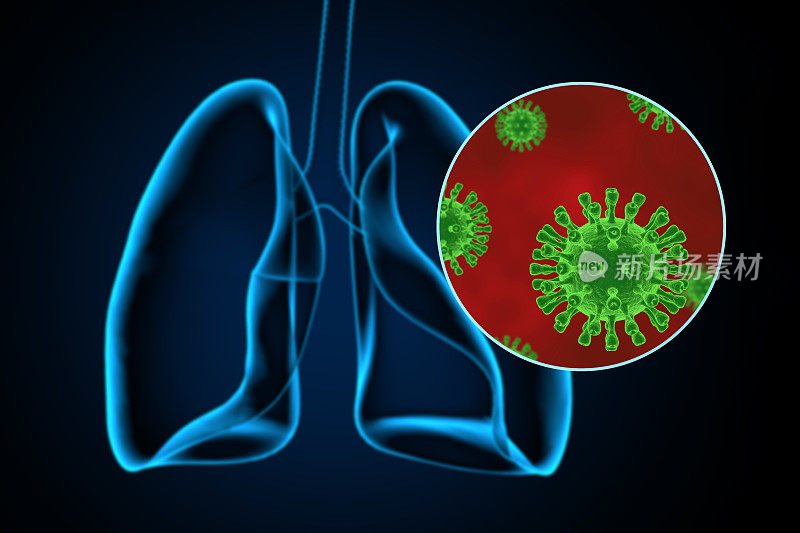 冠状病毒对肺部