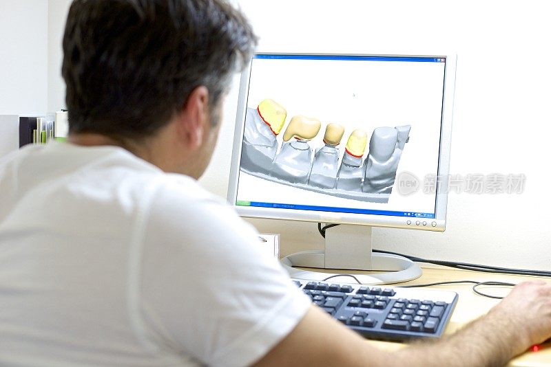 牙科技师设计假体植入物
