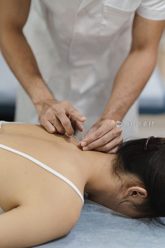 传统中医疗法-亚洲男性医生把针灸针到女性病人的背部