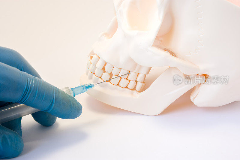 牙齿麻醉或穿刺囊肿牙概念照片。牙科医生手持注射器，将针刺入牙齿上方的上颌，进行牙科麻醉，囊肿穿刺