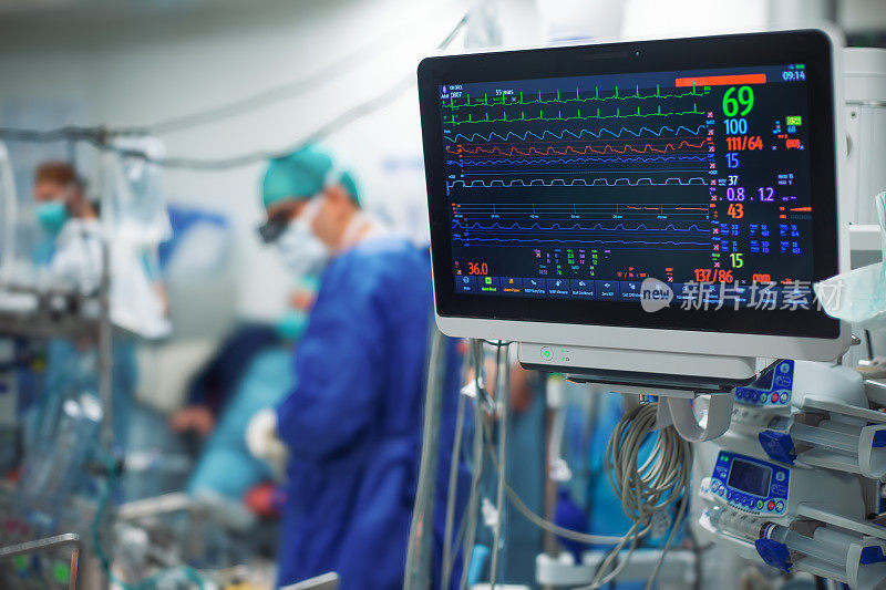 手术室里的手术小组和生命体征监测器