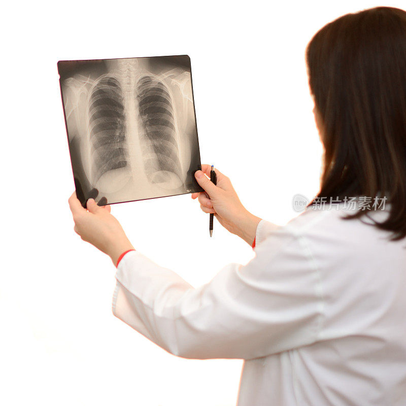 女医生在看人类肺部的x光图像