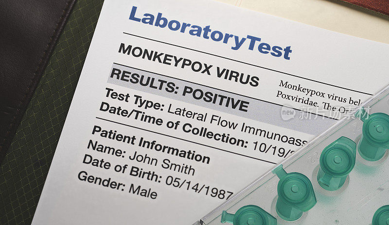 猴痘病毒测试结果用小瓶记录