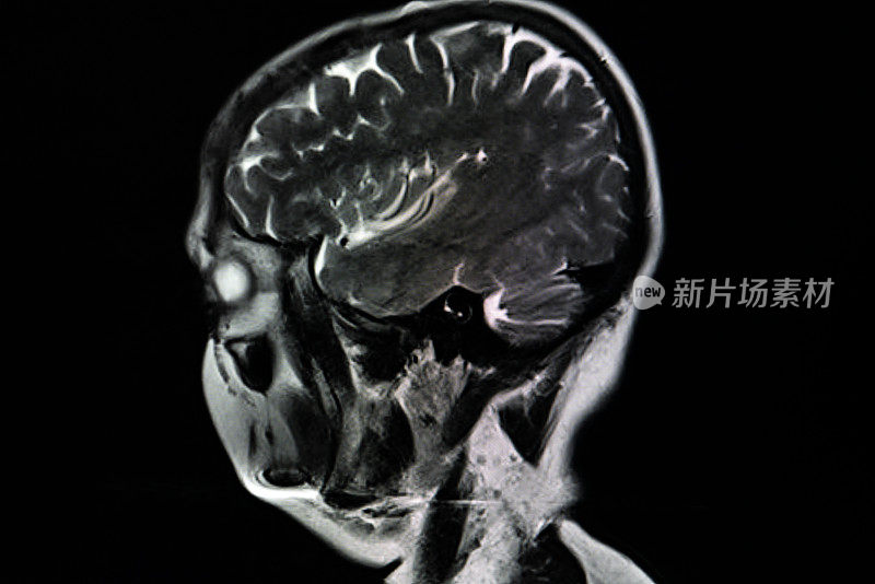 大脑核磁共振扫描。扫描大脑磁共振图像。诊断医疗工具