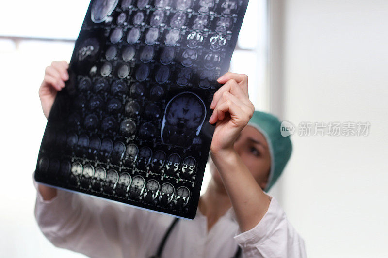 医生拿着一张大脑核磁共振的照片