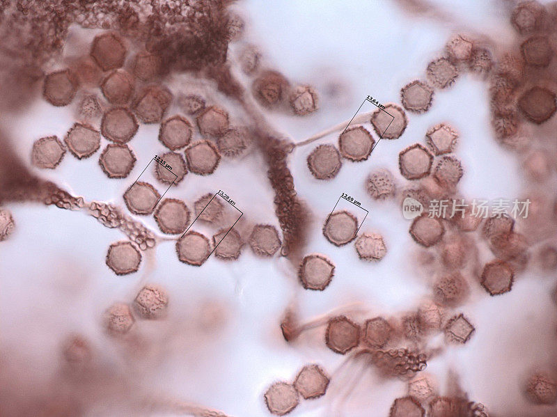 黏菌的孢子。显微镜