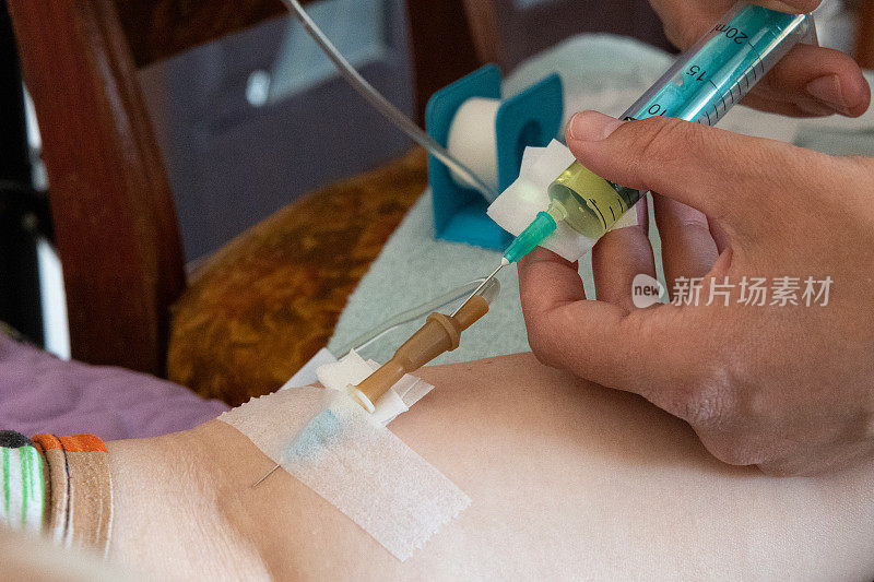 护士在家里通过静脉滴注给病人静脉注射药物。