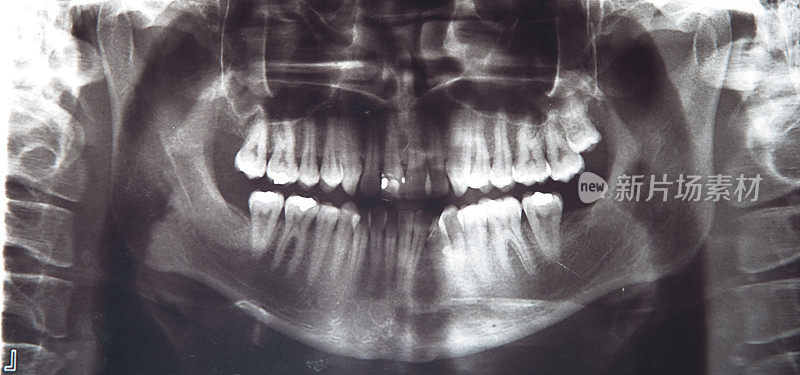 x射线的牙医