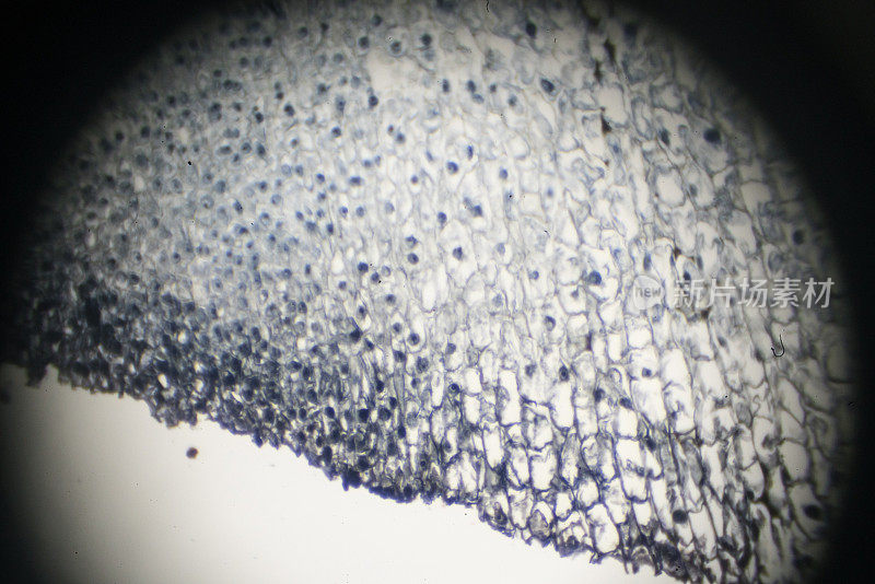 蚕豆根尖在光镜下观察
