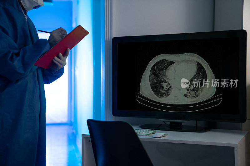 放射科门诊放射科医师检查病人胸部CT影像