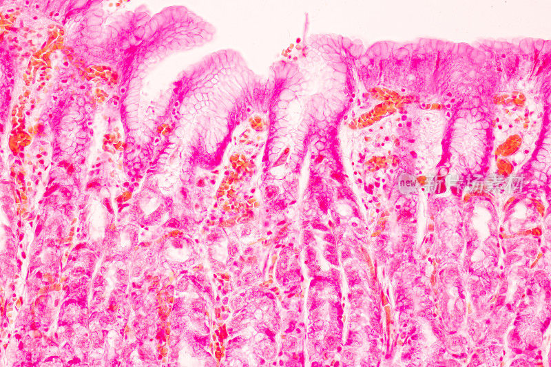 胃人组织在实验室显微镜下的观察。