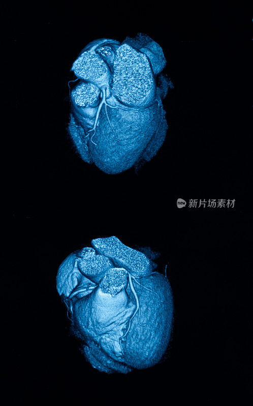 人类心脏MRI三维图像