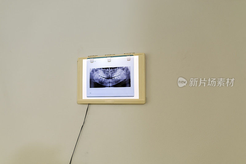 牙科诊所的x光影像