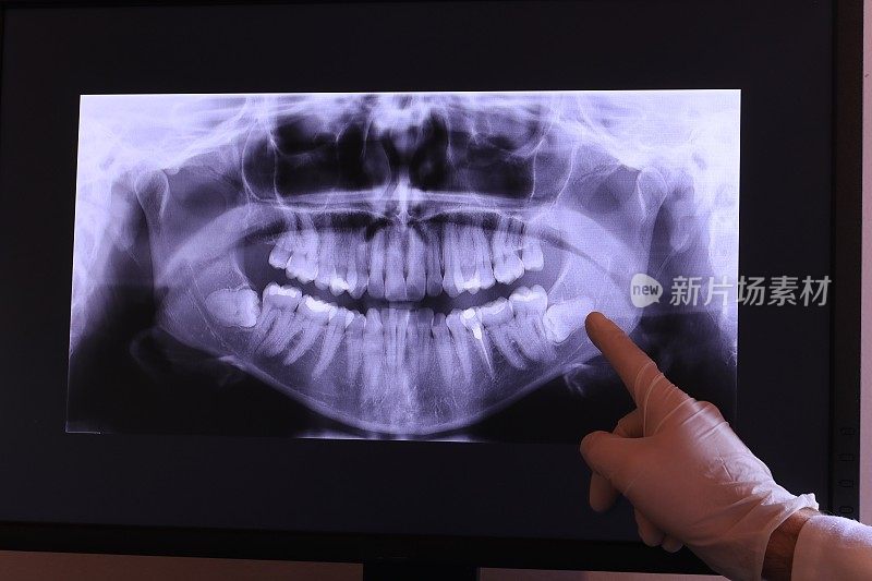 牙科医生检查牙科x光