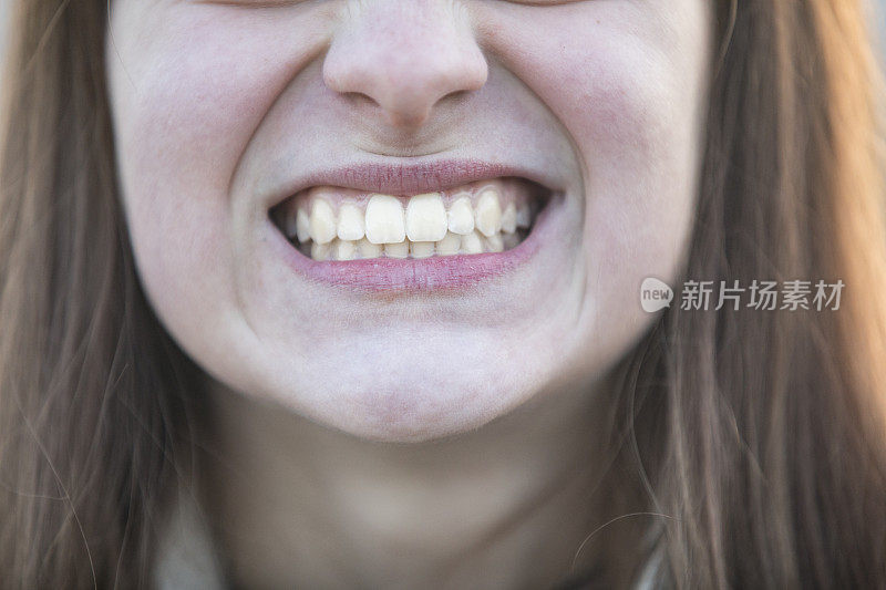 十几岁的女孩显示她的直白牙齿