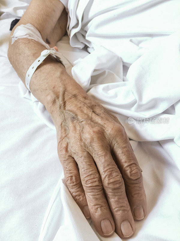 老年妇女手臂静脉注射后支架程序