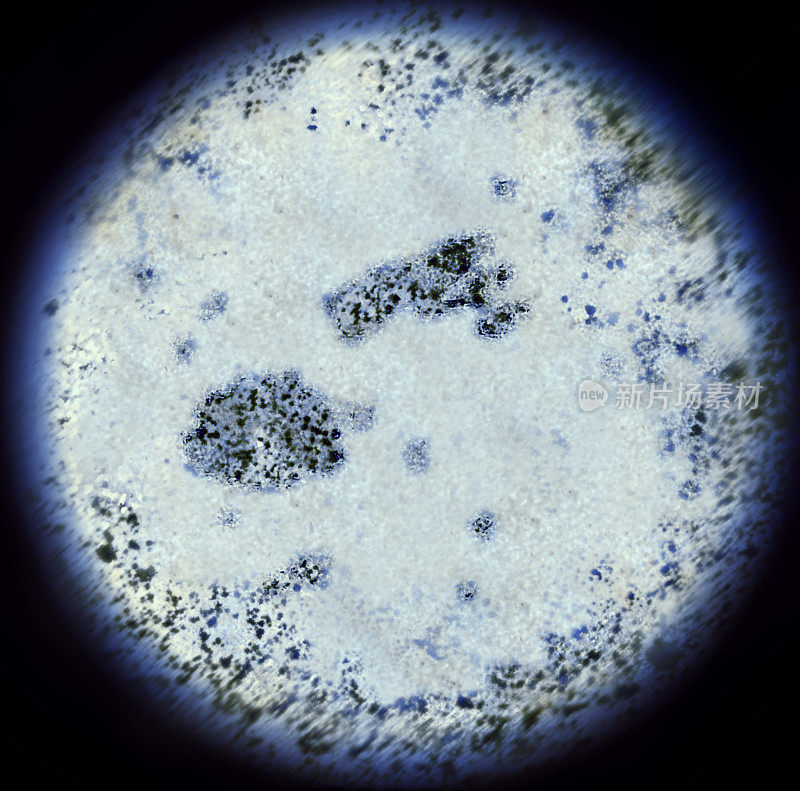 显微镜下的斐济形细菌(系列)