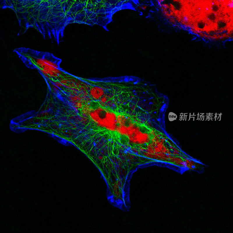 人类神经母细胞瘤细胞的真实荧光显微镜图