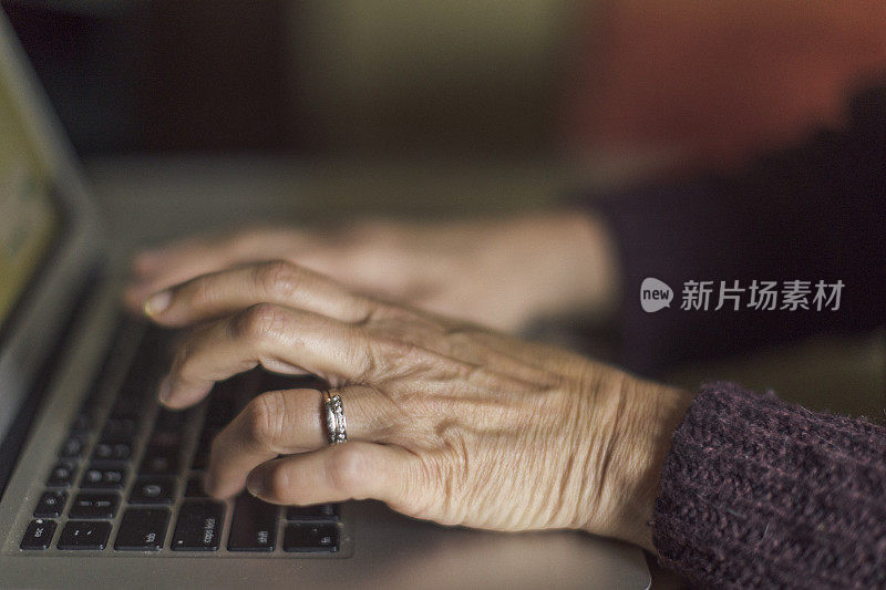 一个面目全非的59岁女人的手，当时她正在咖啡馆里用笔记本电脑工作。
