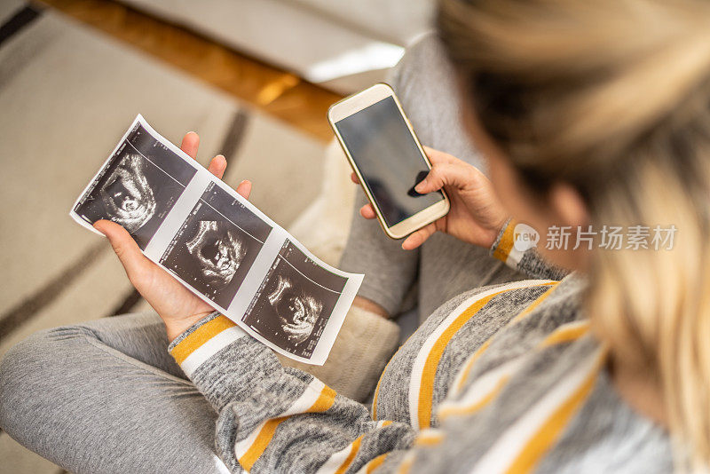 一名孕妇正在做超声波扫描