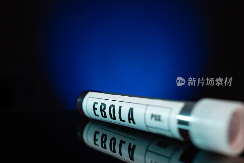 埃博拉病毒血样检测试管特写白标，蓝色背景