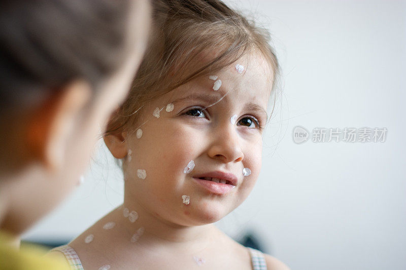 女孩在家里给得了水痘的小妹妹涂面霜