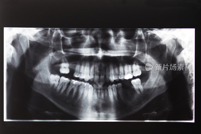 牙齿和口腔的x光图像