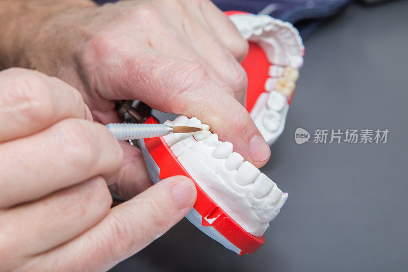 牙医用手拿着牙刷在做陶瓷牙科模型