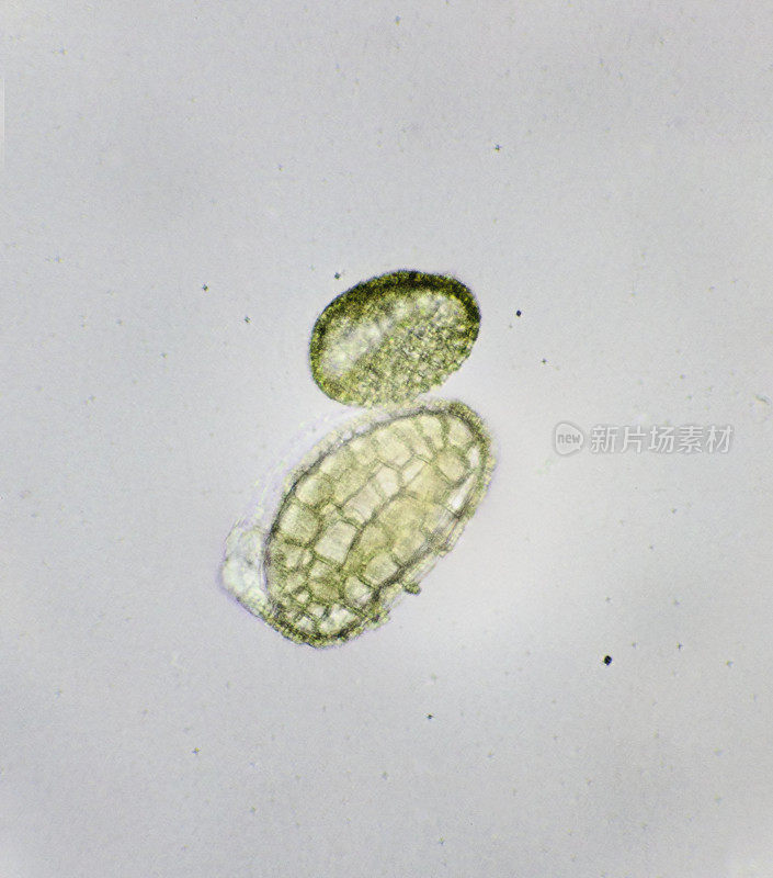 血吸虫卵(寄生扁虫)的显微图