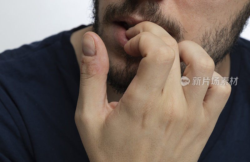 紧张的男性咬指甲在孤立的背景