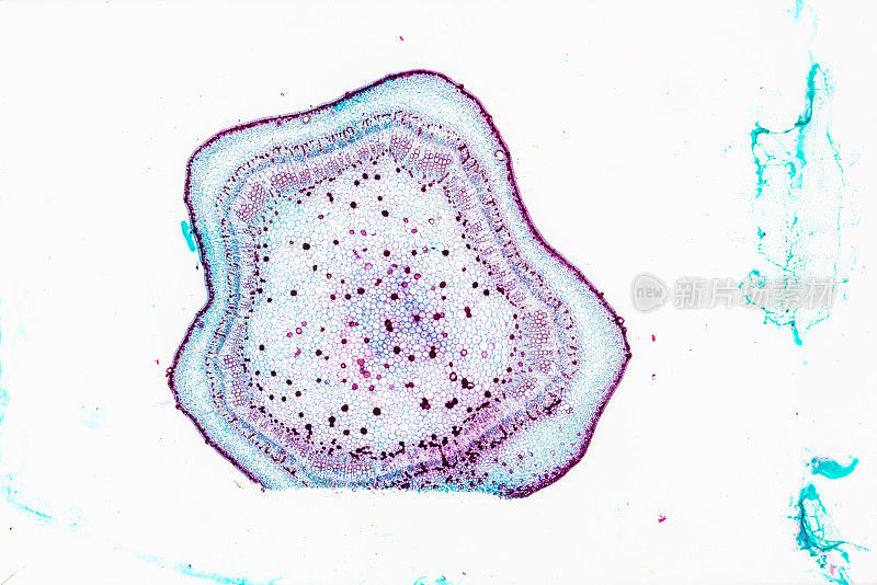 白底光镜下的植物茎-厚壁组织