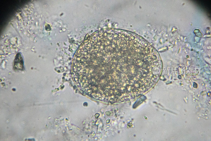 日本血吸虫虫卵光镜下观察